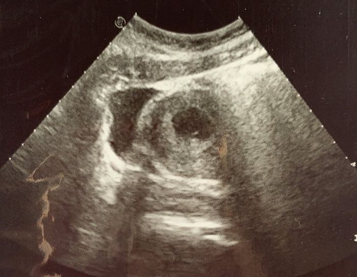 Future mamme novembre 2020 🌞🍁🌷♾ - 1