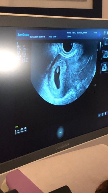 Future mamme novembre 2020 🌞🍁🌷♾ - 1