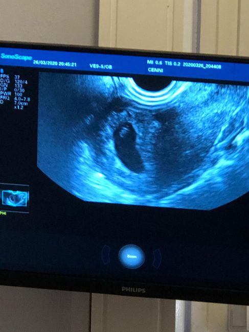 Future mamme novembre 2020 🌞🍁🌷♾ - 2