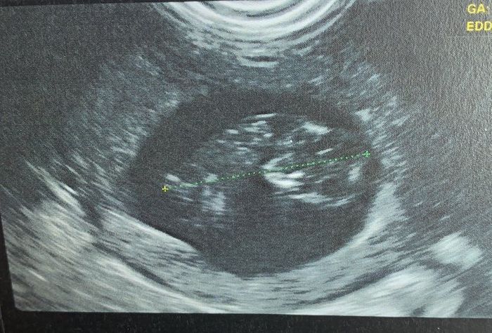 Future mamme novembre 2020 🌞🍁🌷♾ - 1