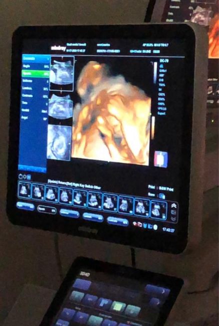 Future mamme novembre 2020 🌞🍁🌷♾ - 2