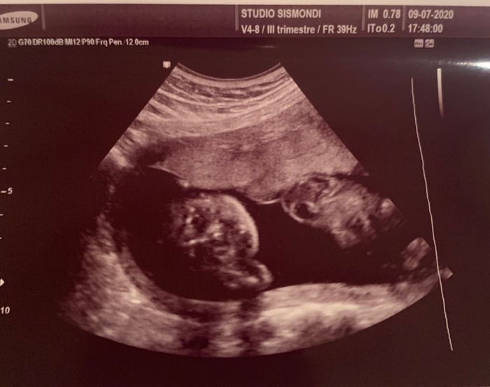 Future mamme novembre 2020 🌞🍁🌷♾ - 1