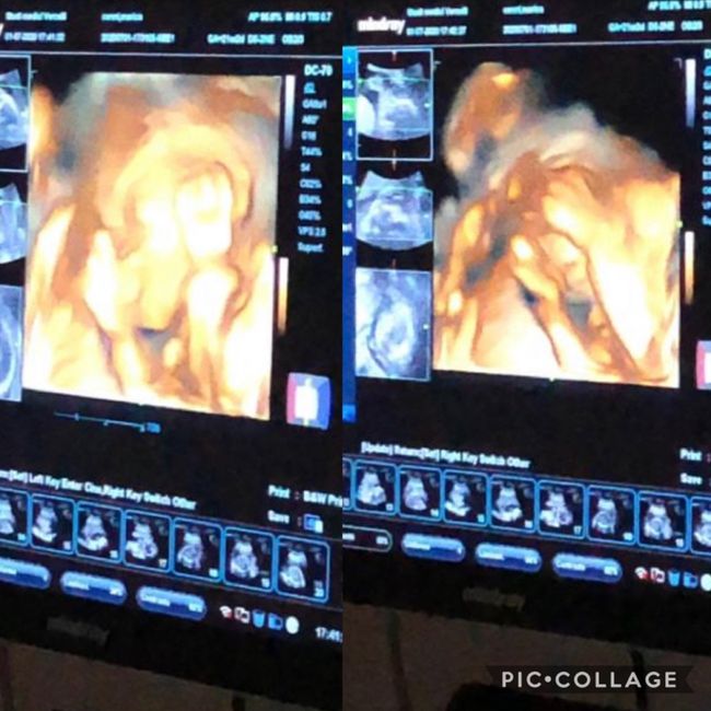 Future mamme novembre 2020 🌞🍁🌷♾ - 1