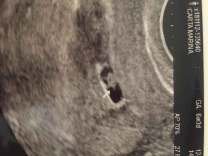 Mamme di luglio 2019 ❤️ - 1