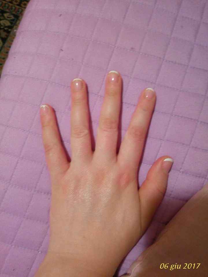 Prova unghie - 1