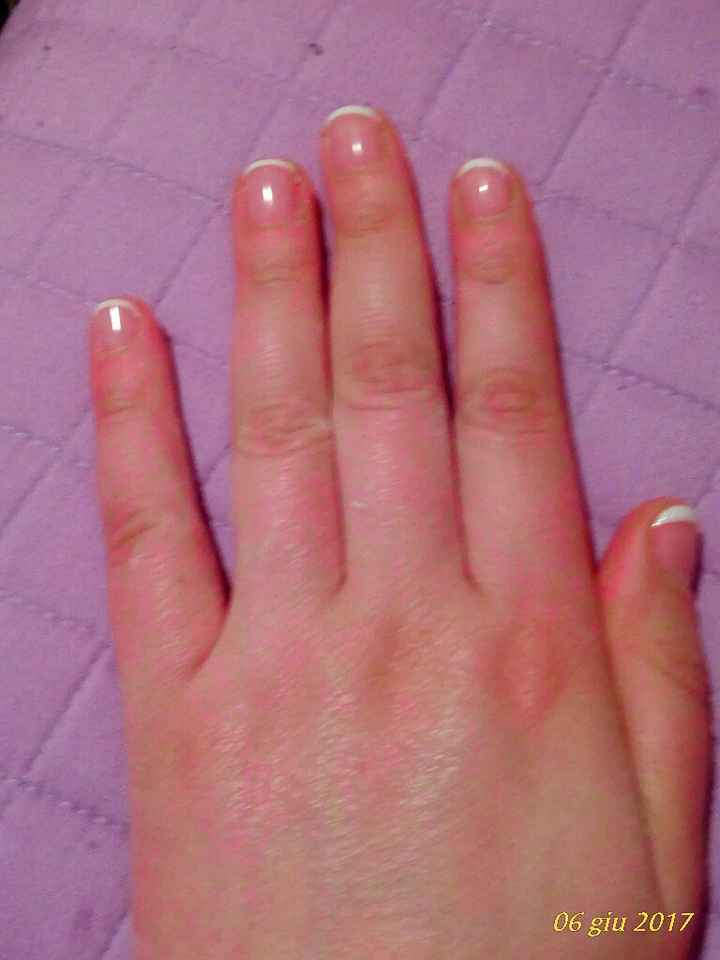 Prova unghie - 2