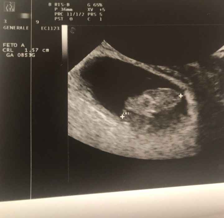 Future Mamme Dicembre 2020 ❤️😍 - 1