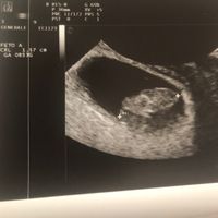 Future Mamme Dicembre 2020 ❤️😍 - 1