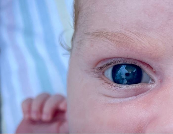 Occhi blu neonato : come diventeranno? - 1