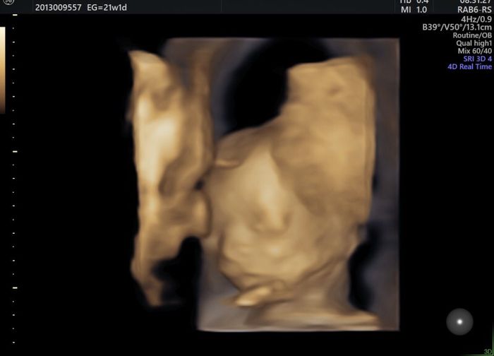 ❤🧡💛💚💙💜 pma 2020, siamo cariche? 💪🏻 - 1