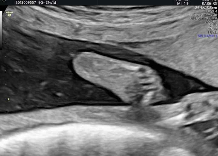 Future Mamme Febbraio 2021 - 2