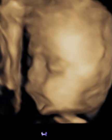 Future Mamme Febbraio 2021 - 1