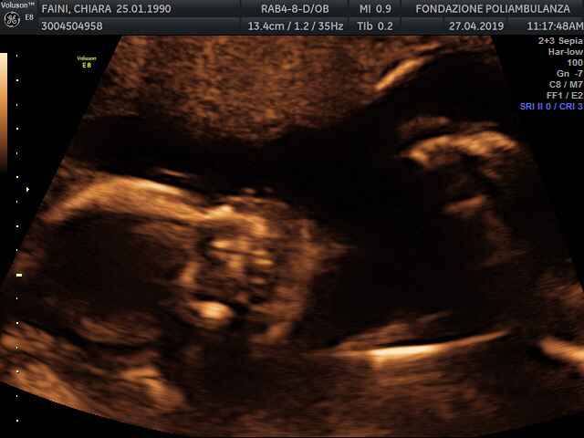 Future mamma settembre 2019 - 1