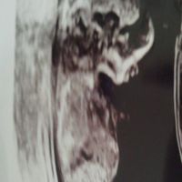 Nub theory curiosità - 1