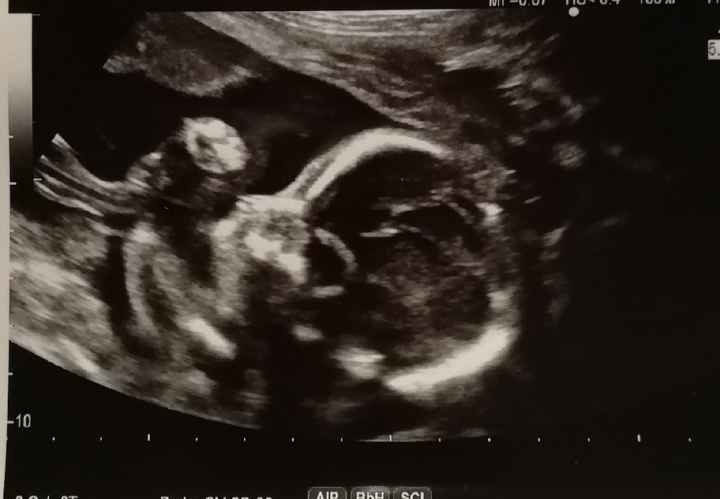 Mamme di Agosto 2020😍🤞😍 - 1