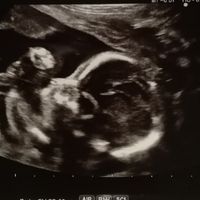 Mamme di Agosto 2020😍🤞😍 - 1