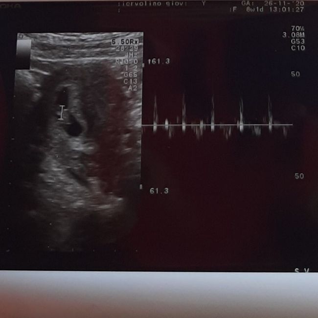 Future mamme Luglio 2021... - 1