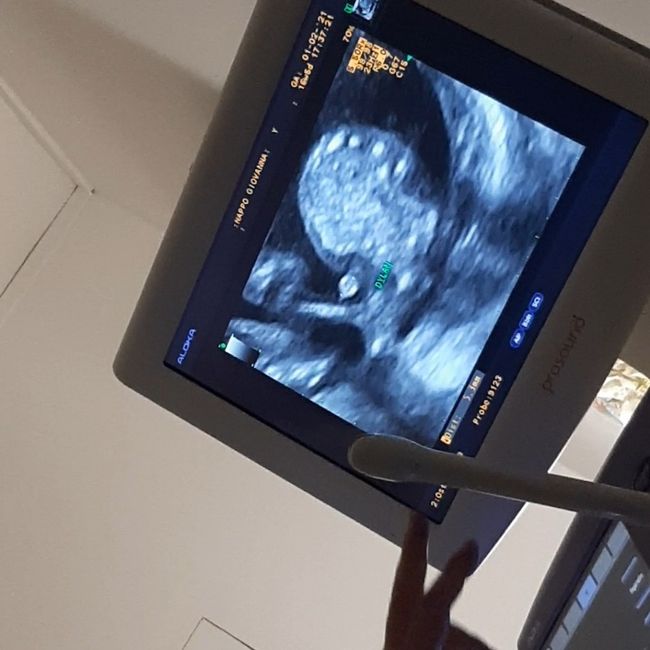 Future mamme Luglio 2021... - 1