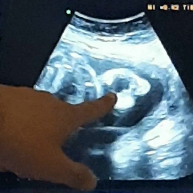 Future mamme Luglio 2021... 2