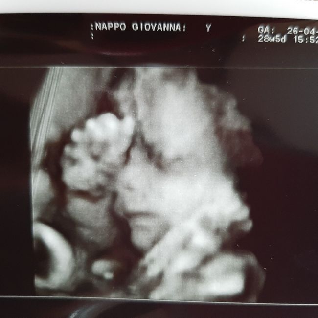 Future mamme Luglio 2021... 1