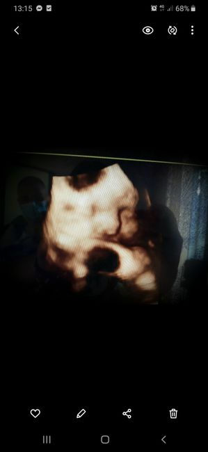 Future mamme Luglio 2021... 1