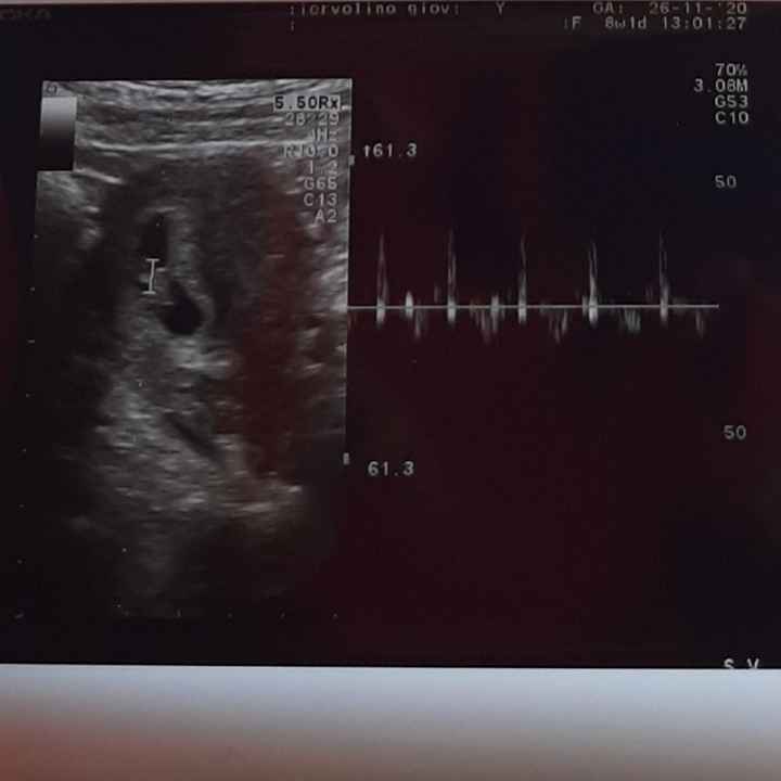 Future mamme Luglio 2021... - 1