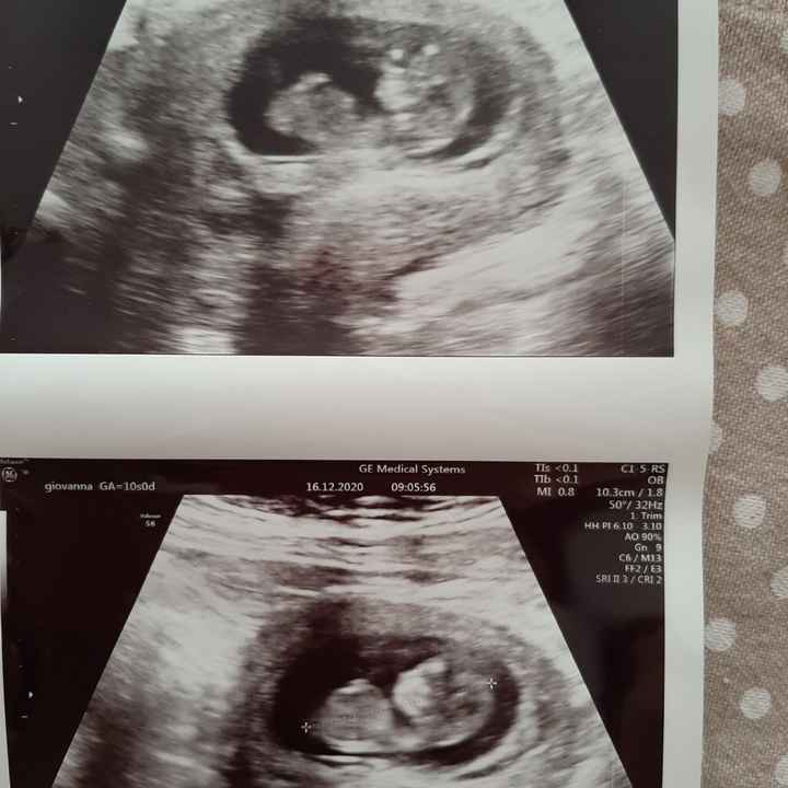 Future mamme Luglio 2021... - 1