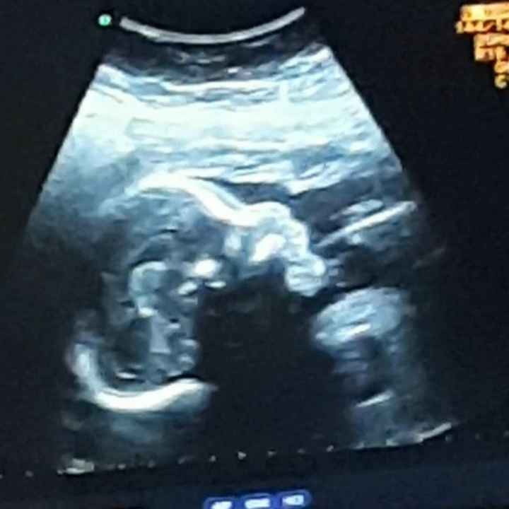 Future mamme Luglio 2021... - 1