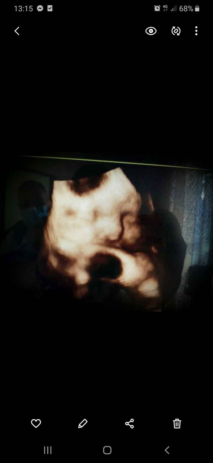 Future mamme Luglio 2021... - 1