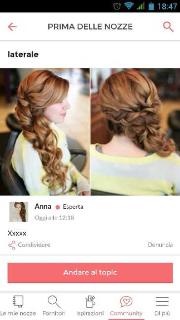 Malata di capelli:la mia vita - 1