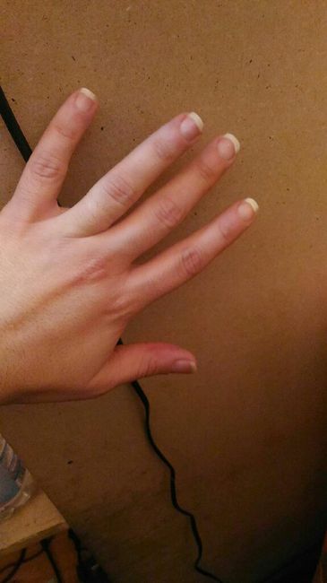  Maledetta Onicofagia.... - 1