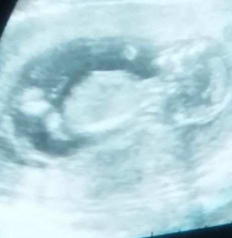 Giorno emozionatissimoo - 1