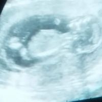 Giorno emozionatissimoo - 1