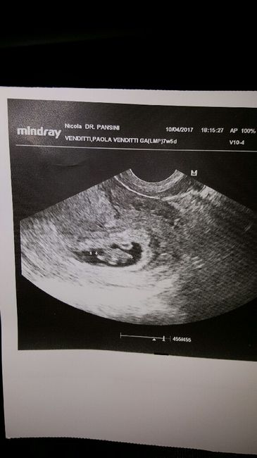 Macchie di sangue scure - 1