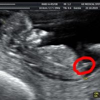Teoria nub - 1