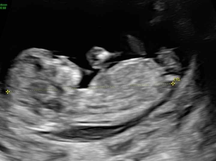 Esperte di Nub Theory a me 8