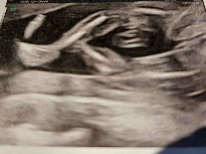 Esperte di Nub Theory a me 7