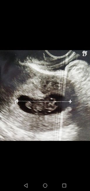 Future Mamme Giugno 2020 - 1