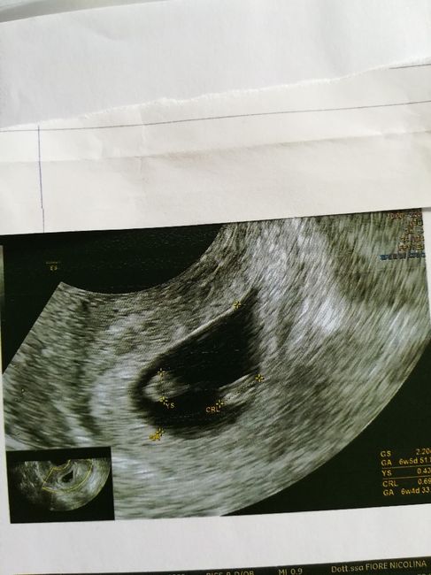 Ramzi ne ha beccate 2 su 2❤️❤️ 6