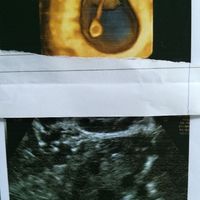 Ramzi ne ha beccate 2 su 2❤️❤️ - 1