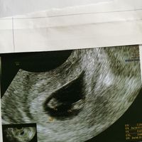 Ramzi ne ha beccate 2 su 2❤️❤️ - 2