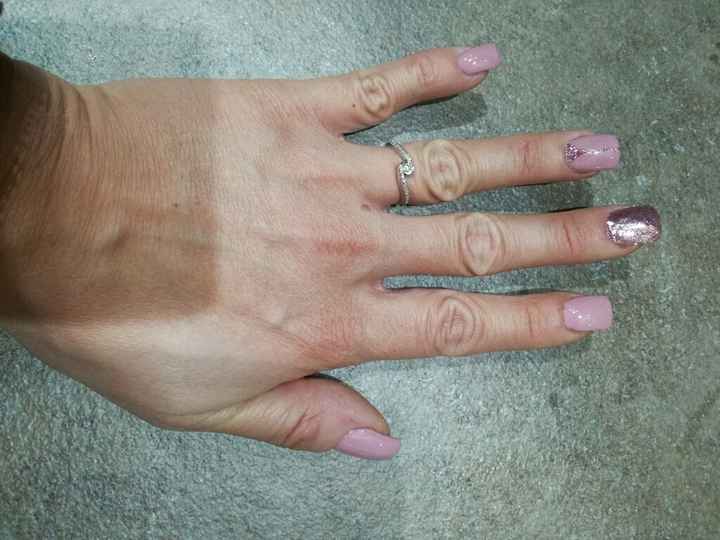 Unghie rosa antico matrimonio? 😓 - 1