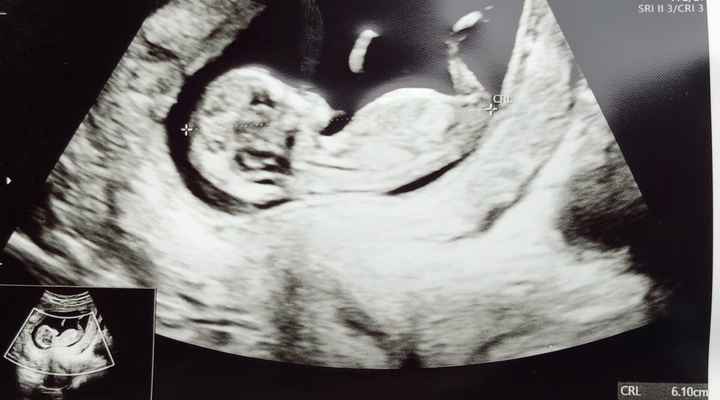 Future mamme novembre 2021 - 1