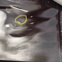 Future mamme novembre 2021 - 2