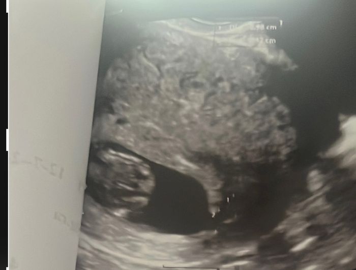 Future mamme Febbraio 2025 - 1