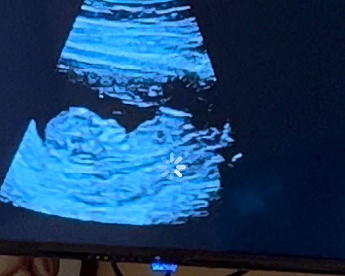 Nub theory, giochiamo un po’ - 1