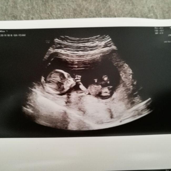 Future Mamme Maggio 2021❤️ - 1