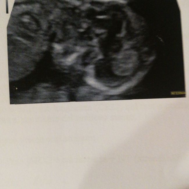 Future Mamme Maggio 2021❤️ - 2