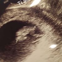 Metodo Ramzi... sfatiamo il mito? 💙 o 💖 - 1