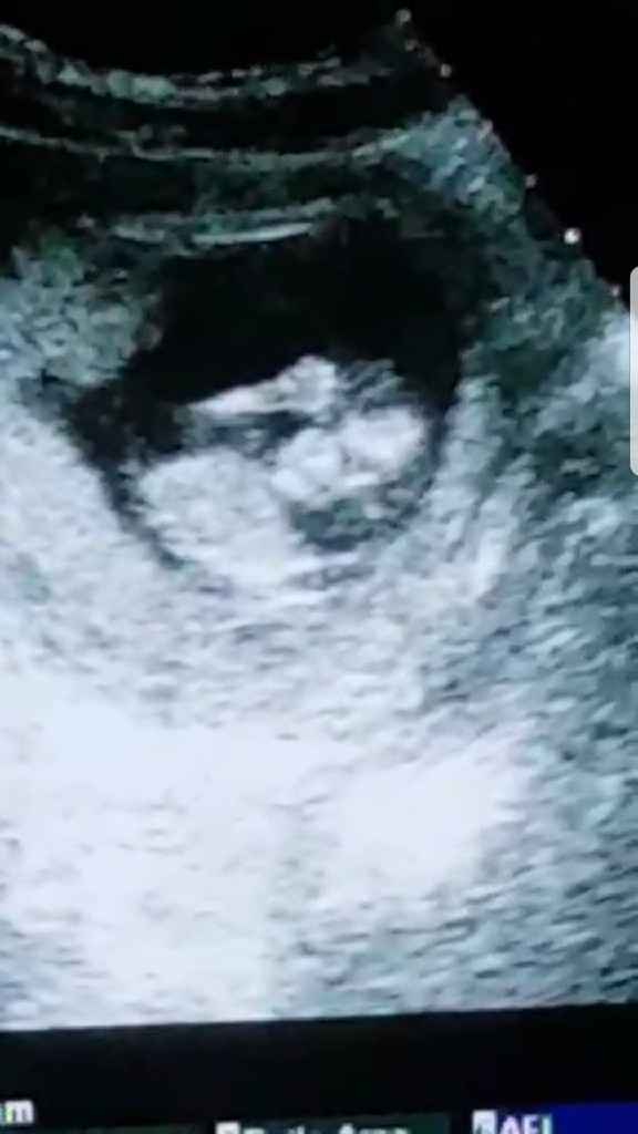 Future mamme di novembre - 1